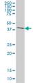 Diphthamide Biosynthesis 1 antibody, H00001801-M02, Novus Biologicals, Western Blot image 