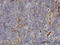 FGR Proto-Oncogene, Src Family Tyrosine Kinase antibody, LS-C133192, Lifespan Biosciences, Immunohistochemistry frozen image 