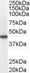 Medium-chain specific acyl-CoA dehydrogenase, mitochondrial antibody, GTX13677, GeneTex, Western Blot image 