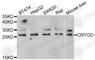 Crystallin Gamma D antibody, A5740, ABclonal Technology, Western Blot image 
