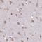 RNA Binding Motif Protein 4B antibody, NBP2-33503, Novus Biologicals, Immunohistochemistry paraffin image 