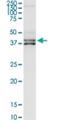 Complement Factor H Related 1 antibody, H00003078-D01P, Novus Biologicals, Western Blot image 
