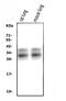 Pulmonary surfactant-associated protein A antibody, PA1458, Boster Biological Technology, Western Blot image 