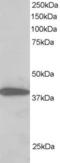 Microtubule Affinity Regulating Kinase 4 antibody, orb18572, Biorbyt, Western Blot image 