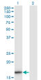 Interleukin 36 Beta antibody, LS-C139455, Lifespan Biosciences, Western Blot image 