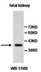 Abhydrolase Domain Containing 15 antibody, orb77516, Biorbyt, Western Blot image 