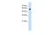 C-Type Lectin Domain Family 4 Member M antibody, PA5-42164, Invitrogen Antibodies, Western Blot image 