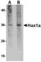 HCLS1 Associated Protein X-1 antibody, M01495, Boster Biological Technology, Western Blot image 