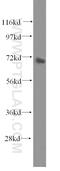G Protein-Coupled Receptor Kinase 5 antibody, 17032-1-AP, Proteintech Group, Western Blot image 