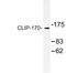 CAP-Gly Domain Containing Linker Protein 1 antibody, LS-C177444, Lifespan Biosciences, Western Blot image 