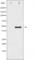 Calcium/Calmodulin Dependent Protein Kinase II Alpha antibody, abx010488, Abbexa, Western Blot image 