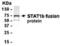 Signal Transducer And Activator Of Transcription 1 antibody, XW-8106, ProSci, Western Blot image 