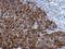 Nucleolar Protein 3 antibody, LS-C155359, Lifespan Biosciences, Immunohistochemistry paraffin image 