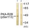 Protein Kinase CAMP-Dependent Type II Regulatory Subunit Beta antibody, PA5-38508, Invitrogen Antibodies, Western Blot image 