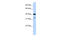 2'-5'-Oligoadenylate Synthetase 1 antibody, 27-235, ProSci, Western Blot image 