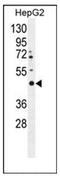 Leucine Rich Repeats And Transmembrane Domains 2 antibody, AP52551PU-N, Origene, Western Blot image 