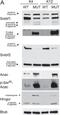 Sterol Regulatory Element Binding Transcription Factor 2 antibody, NBP1-71880, Novus Biologicals, Western Blot image 