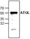 Patatin Like Phospholipase Domain Containing 2 antibody, GTX59676, GeneTex, Western Blot image 