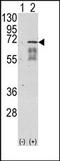 Activin A Receptor Type 1 antibody, AP13706PU-N, Origene, Western Blot image 