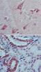 Interleukin 22 antibody, NBP2-27339, Novus Biologicals, Immunohistochemistry paraffin image 