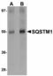 Sequestosome 1 antibody, LS-B4617, Lifespan Biosciences, Western Blot image 