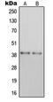 Purinergic Receptor P2Y14 antibody, orb214945, Biorbyt, Western Blot image 