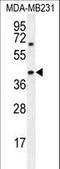 Alpha-Methylacyl-CoA Racemase antibody, LS-C156302, Lifespan Biosciences, Western Blot image 