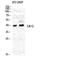 Carbonic Anhydrase 12 antibody, A04063, Boster Biological Technology, Western Blot image 