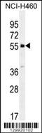 Shisa Family Member 6 antibody, 56-112, ProSci, Western Blot image 