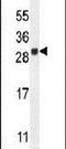 LY6/PLAUR Domain Containing 4 antibody, PA5-23848, Invitrogen Antibodies, Western Blot image 