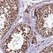 Zinc Finger Protein 766 antibody, HPA044882, Atlas Antibodies, Immunohistochemistry frozen image 