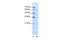 Dihydrolipoamide S-Acetyltransferase antibody, GTX47093, GeneTex, Western Blot image 