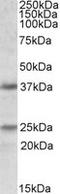 Podoplanin antibody, LS-C108124, Lifespan Biosciences, Western Blot image 