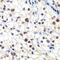 General Transcription Factor IIF Subunit 2 antibody, FNab03710, FineTest, Immunohistochemistry paraffin image 