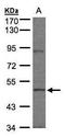 Protein Tyrosine Kinase 6 antibody, GTX107671, GeneTex, Western Blot image 