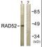 RAD52 Homolog, DNA Repair Protein antibody, orb96028, Biorbyt, Western Blot image 