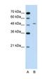 Glutamic--Pyruvic Transaminase antibody, orb330440, Biorbyt, Western Blot image 