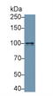 Neuropilin 1 antibody, LS-C299259, Lifespan Biosciences, Western Blot image 