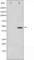 Jun Proto-Oncogene, AP-1 Transcription Factor Subunit antibody, abx011039, Abbexa, Western Blot image 