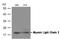 Myosin regulatory light chain 2, ventricular/cardiac muscle isoform antibody, AP02680PU-N, Origene, Western Blot image 