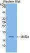 Glucagon-like peptide 1 receptor antibody, LS-C373170, Lifespan Biosciences, Western Blot image 