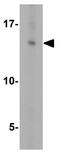 GABA Type A Receptor-Associated Protein antibody, GTX31541, GeneTex, Western Blot image 