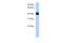 Leucine Rich Repeat Containing 17 antibody, A14400, Boster Biological Technology, Western Blot image 