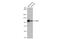 Hepatocyte Growth Factor-Regulated Tyrosine Kinase Substrate antibody, GTX101718, GeneTex, Western Blot image 