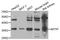 AKT Interacting Protein antibody, STJ27995, St John