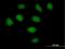SECIS Binding Protein 2 antibody, H00079048-B01P, Novus Biologicals, Immunocytochemistry image 
