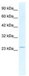 SRY-Box 14 antibody, TA339089, Origene, Western Blot image 