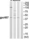 TNF Alpha Induced Protein 6 antibody, TA314635, Origene, Western Blot image 