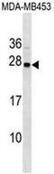 Synaptogyrin 1 antibody, AP54125PU-N, Origene, Western Blot image 