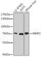 Matrix Metallopeptidase 2 antibody, 22-080, ProSci, Western Blot image 